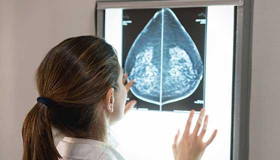 女妇科医生在医院看乳房x光片 